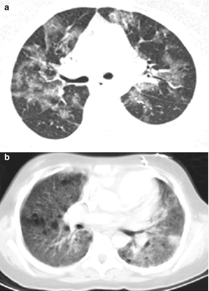 figure 24