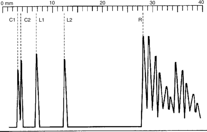 figure 16