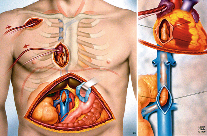 figure 28