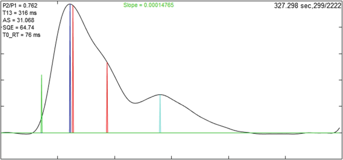 figure 21