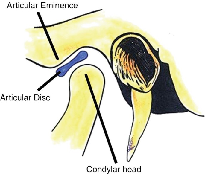 TMJ and MRI Anatomy | SpringerLink TMJ and MRI Anatomy | SpringerLink