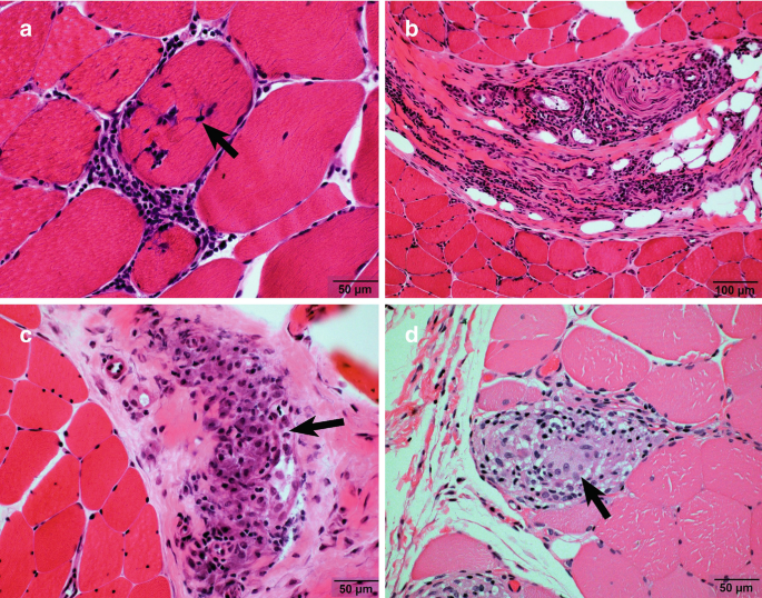 figure 22