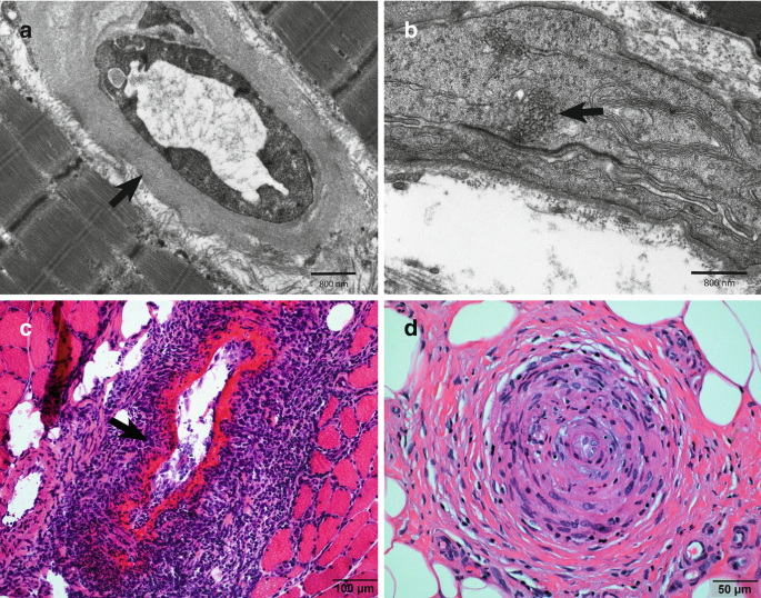 figure 23