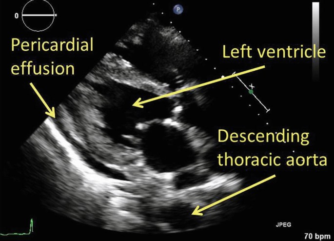 figure 22