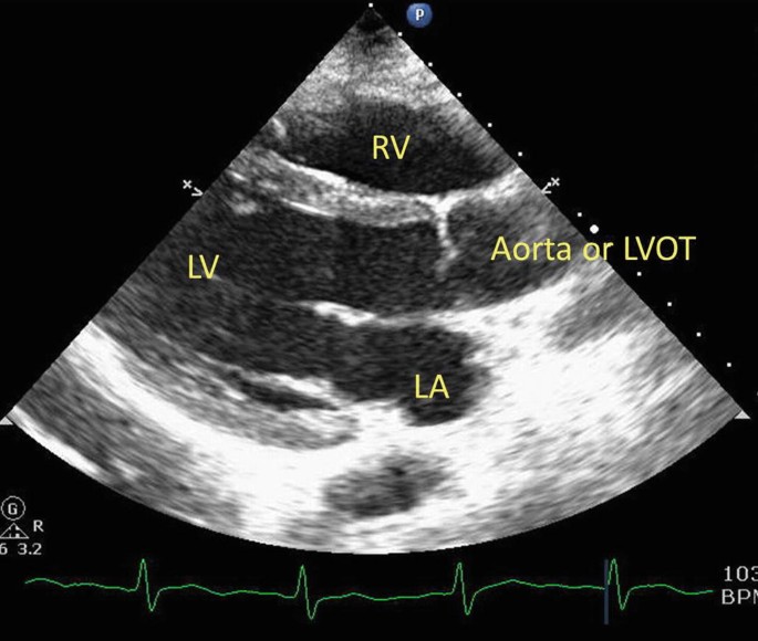 figure 24