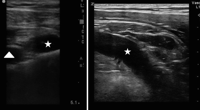 figure 28