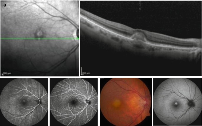 figure 16