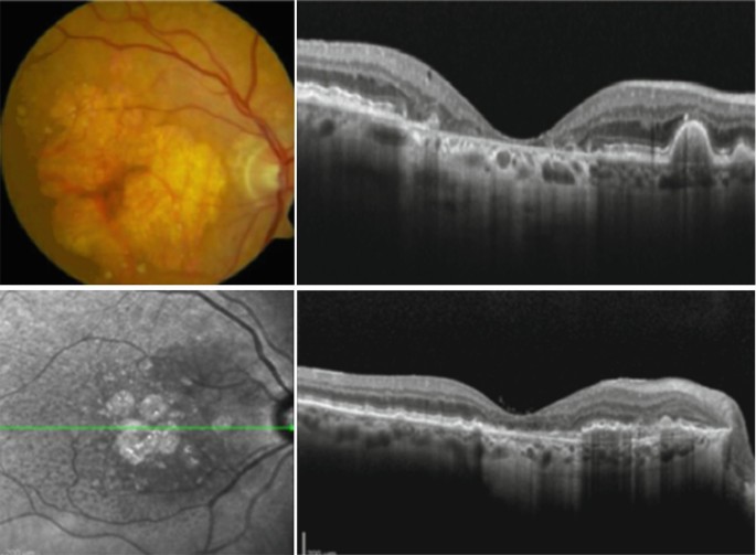 figure 18