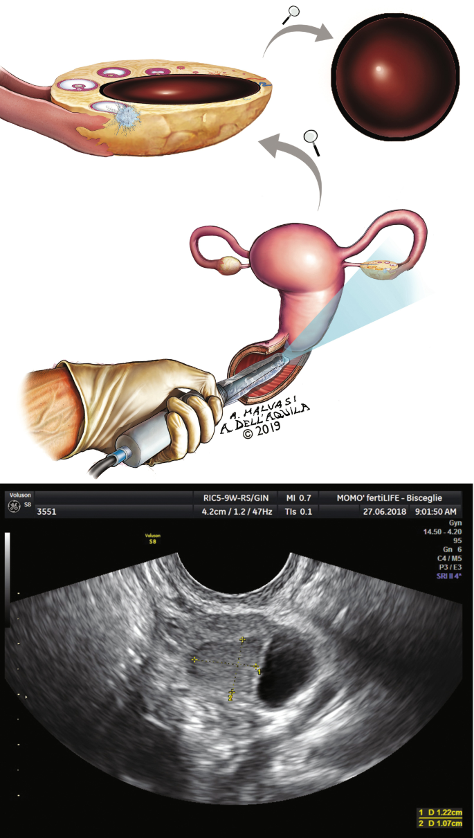 figure 19