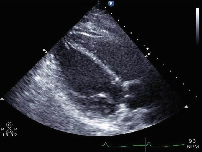Ultrasound for Shock Evaluation, Resuscitation, and Critical Care  Procedures