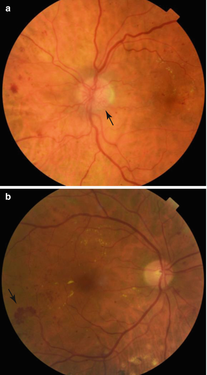 Downloadable Amsler Grid - Central Triad Retina Physicians