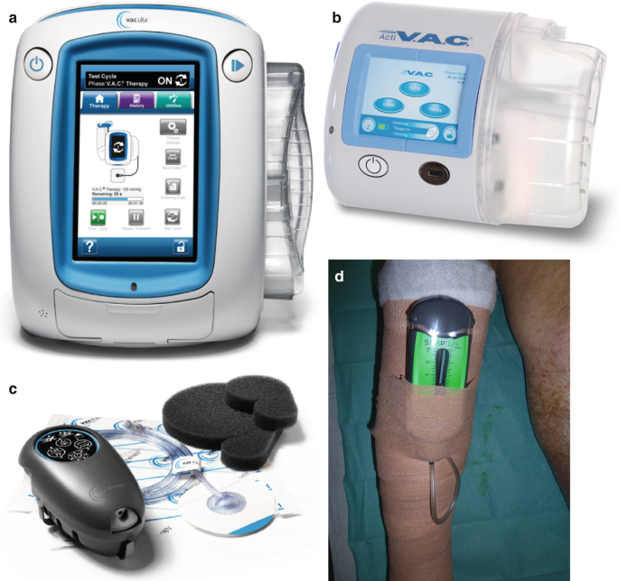 Negative Pressure Wound Therapy | SpringerLink