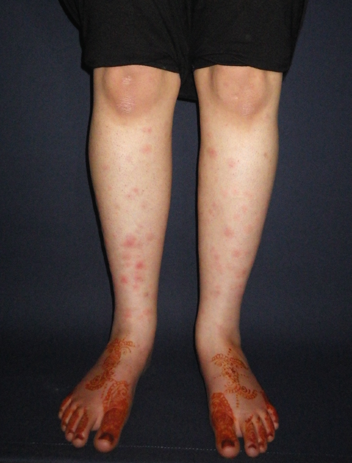Skin in Systemic Disease | SpringerLink
