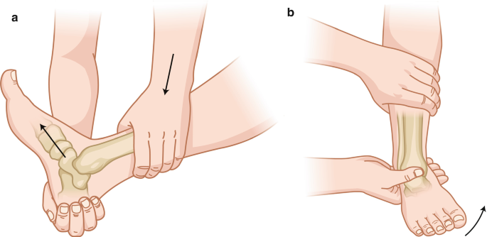 Ankle Orthopaedic Test: Talar tilt