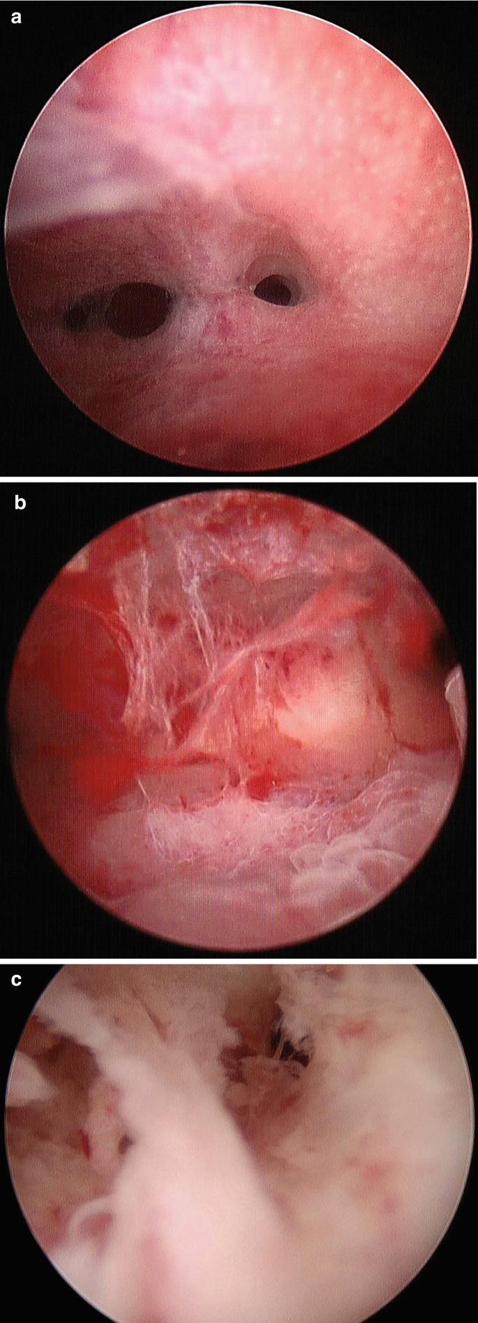 figure 21