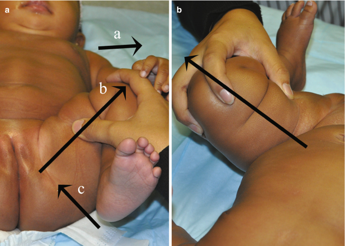 pedactric genital exam of child 