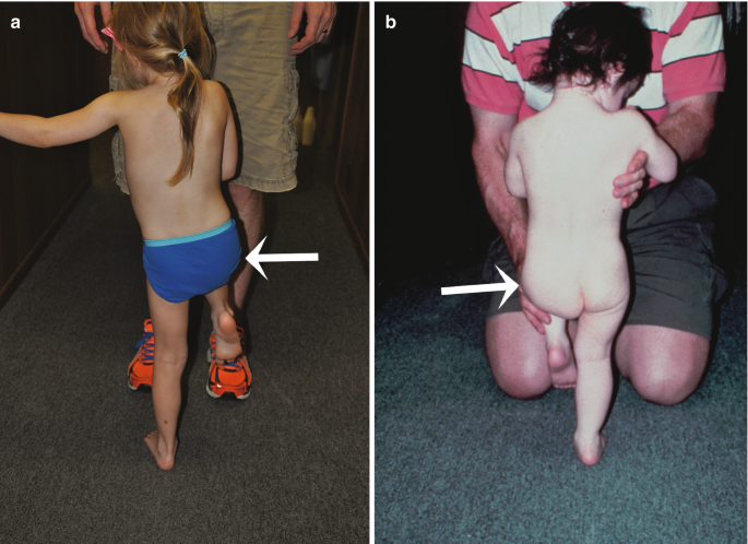 genital pediatric exam Pediatric Urology | Doernbecher Children's Hospital | OHSU