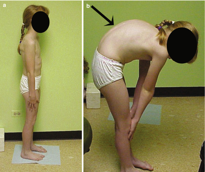 pediatric genital exam 