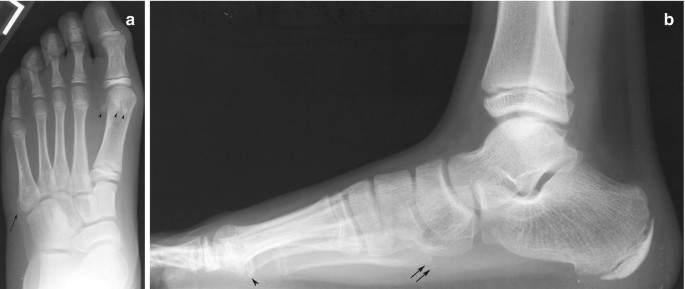 Radiology of the Pediatric Foot and Ankle