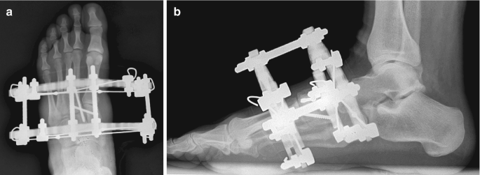 figure 16