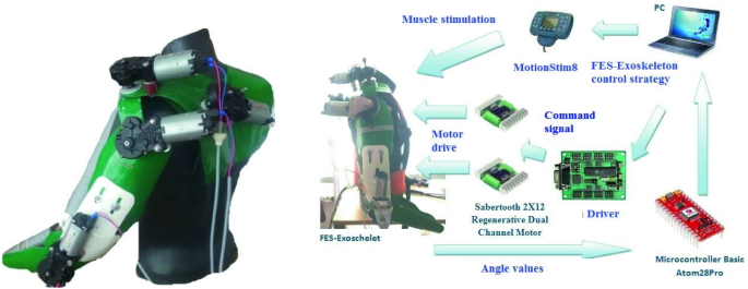 Functional electrical stimulation in neurorehabilitation (Chapter 12) -  Textbook of Neural Repair and Rehabilitation