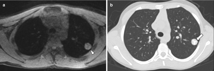 figure 26