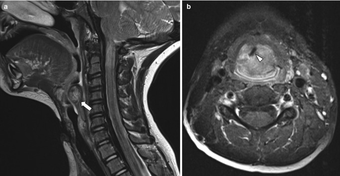 figure 29