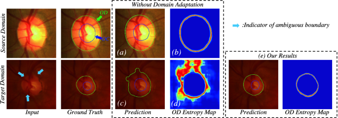 Boundary and Entropy-Driven Adversarial Learning for Fundus Image 