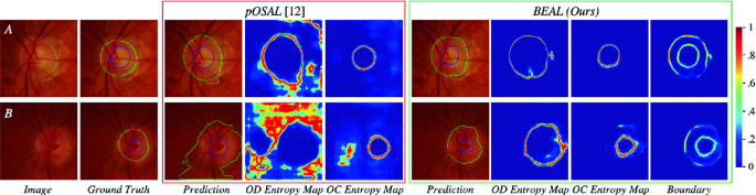 Boundary and Entropy-Driven Adversarial Learning for Fundus Image 