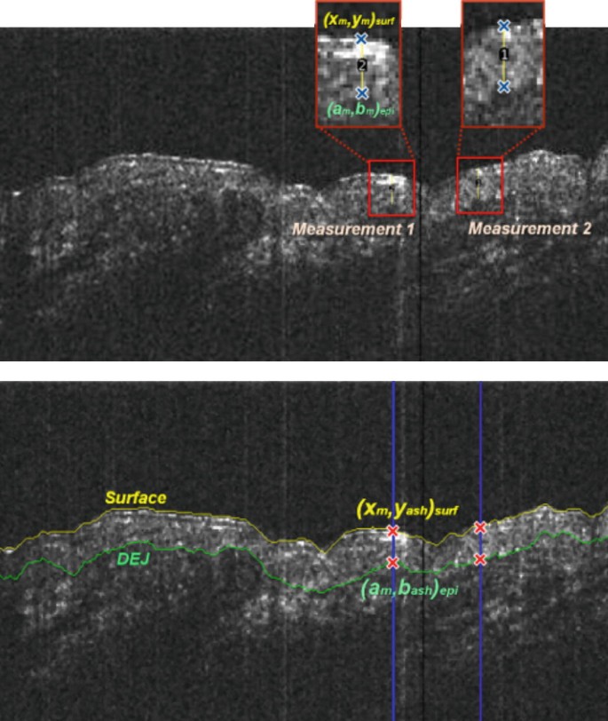 Techniques And Applications In Skin Oct Analysis Springerlink