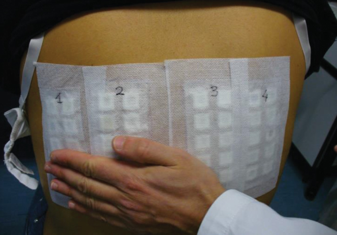 Patch Testing