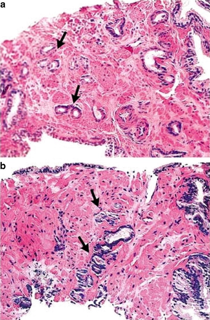 The Temple University Hospital Digital Pathology Corpus Springerlink