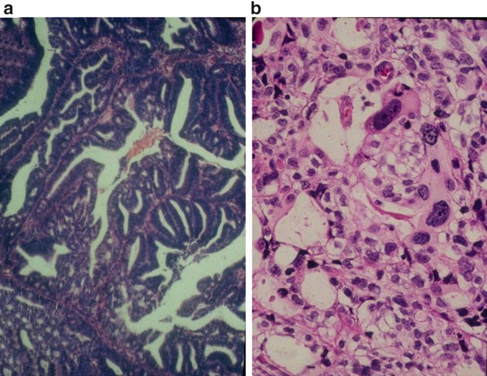 figure 34