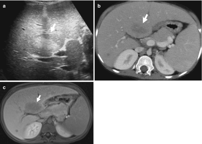 figure 18