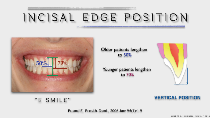 Incisal Edge Position: Its Importance to Aesthetics and Function 
