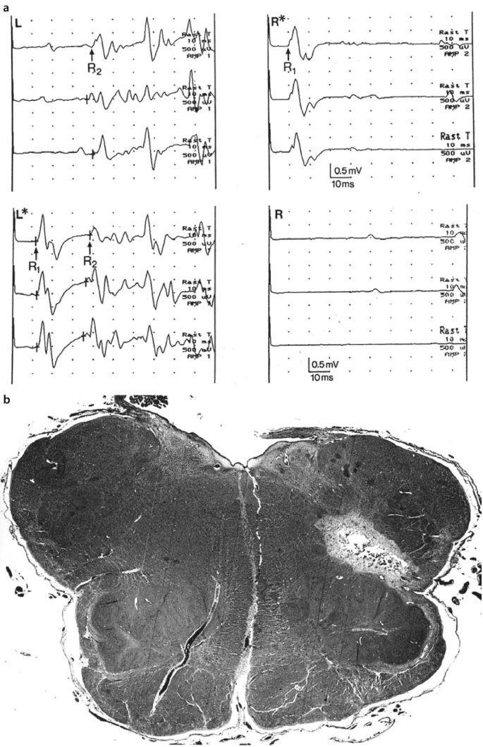 figure 30