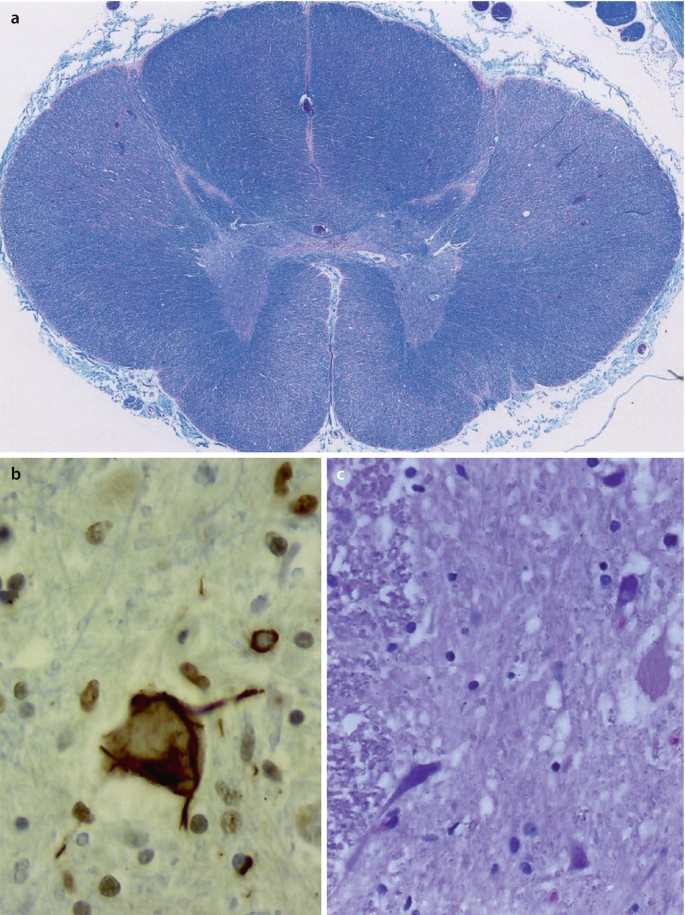 MED 612: Spinal Cord Laminae & Histology