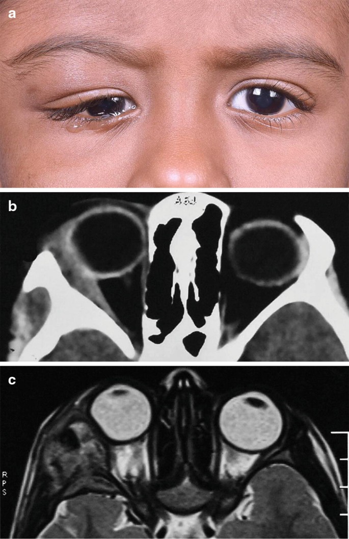 figure b