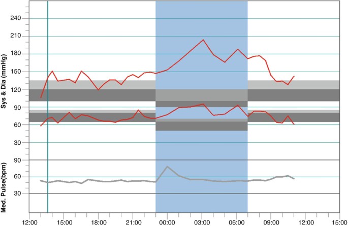 Blood Pressure The Interactions Between Hypertension And Kidney Disease Springerlink