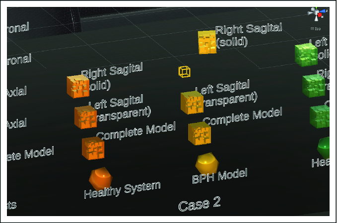 Virtual Reality Tools Applied to the Male Urinary System