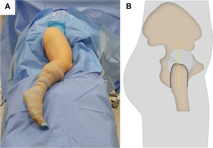 My Hip Hurts When I Sleep on My Side: Joshua D. Harris, MD: Orthopaedic  Surgery