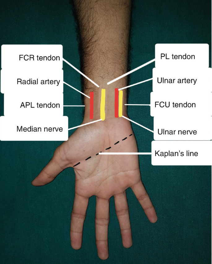 Palmar and radial views of the hand showing the lump at the base of the...  | Download Scientific Diagram