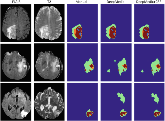 figure 15