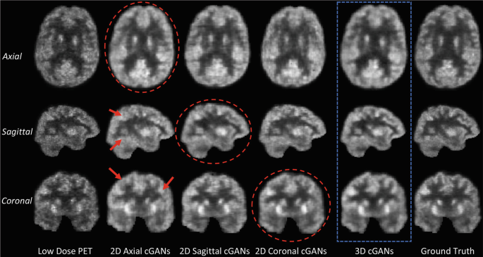 figure 30