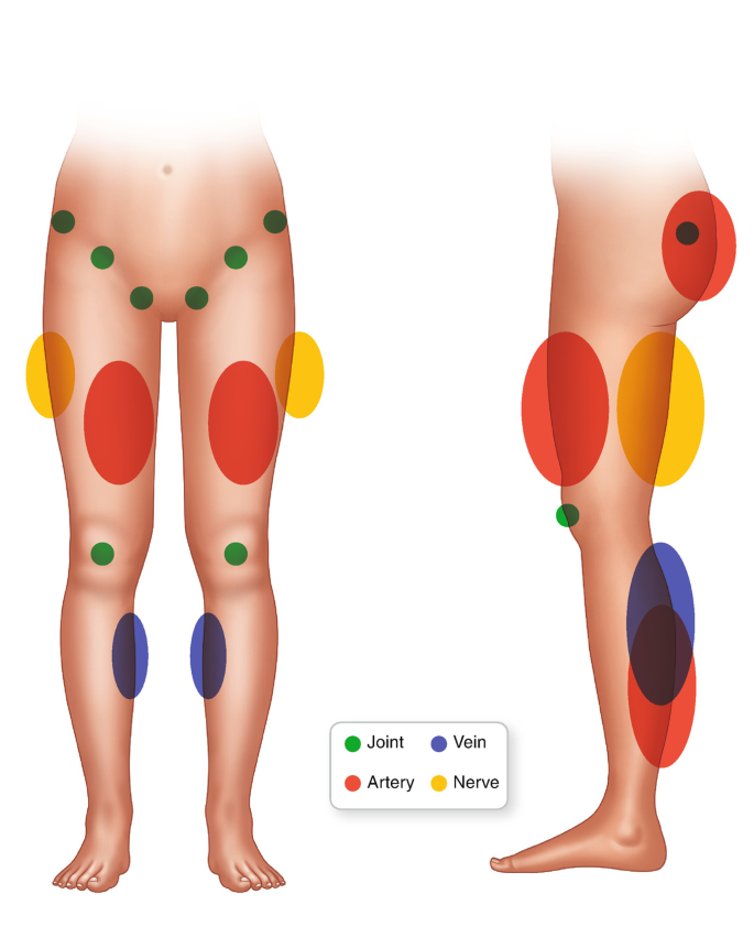 Evaluation of Leg Pain | SpringerLink
