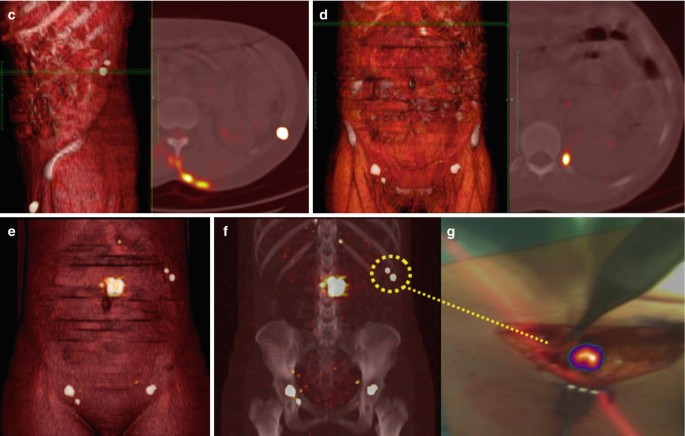 figure 21