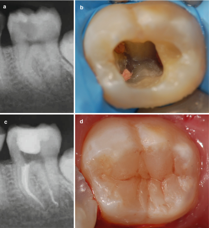 figure 19