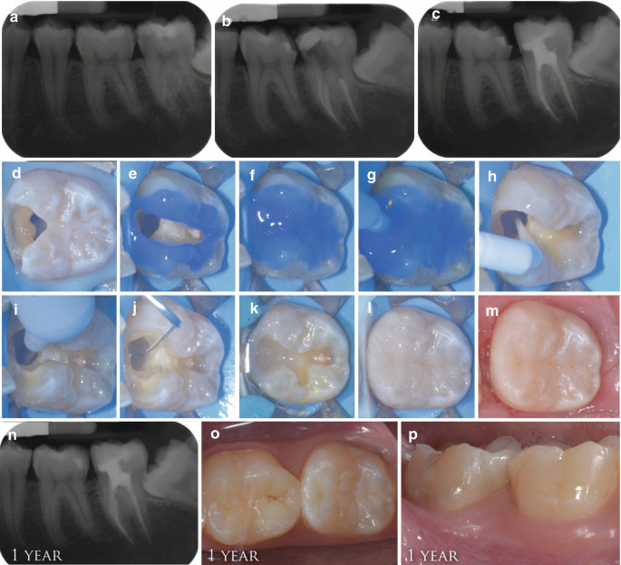 figure 21