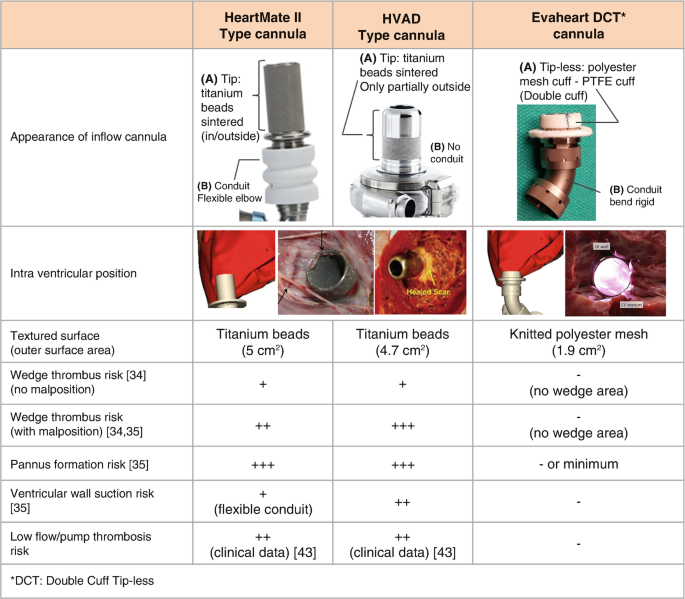 EVAHEART 2 Left Ventricular Assist System: A Hemocompatible Centrifugal  Pump with Physiological Pulsatility | SpringerLink
