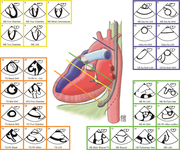 Transesophageal Echocardiogram - Garani Cardiac Centre